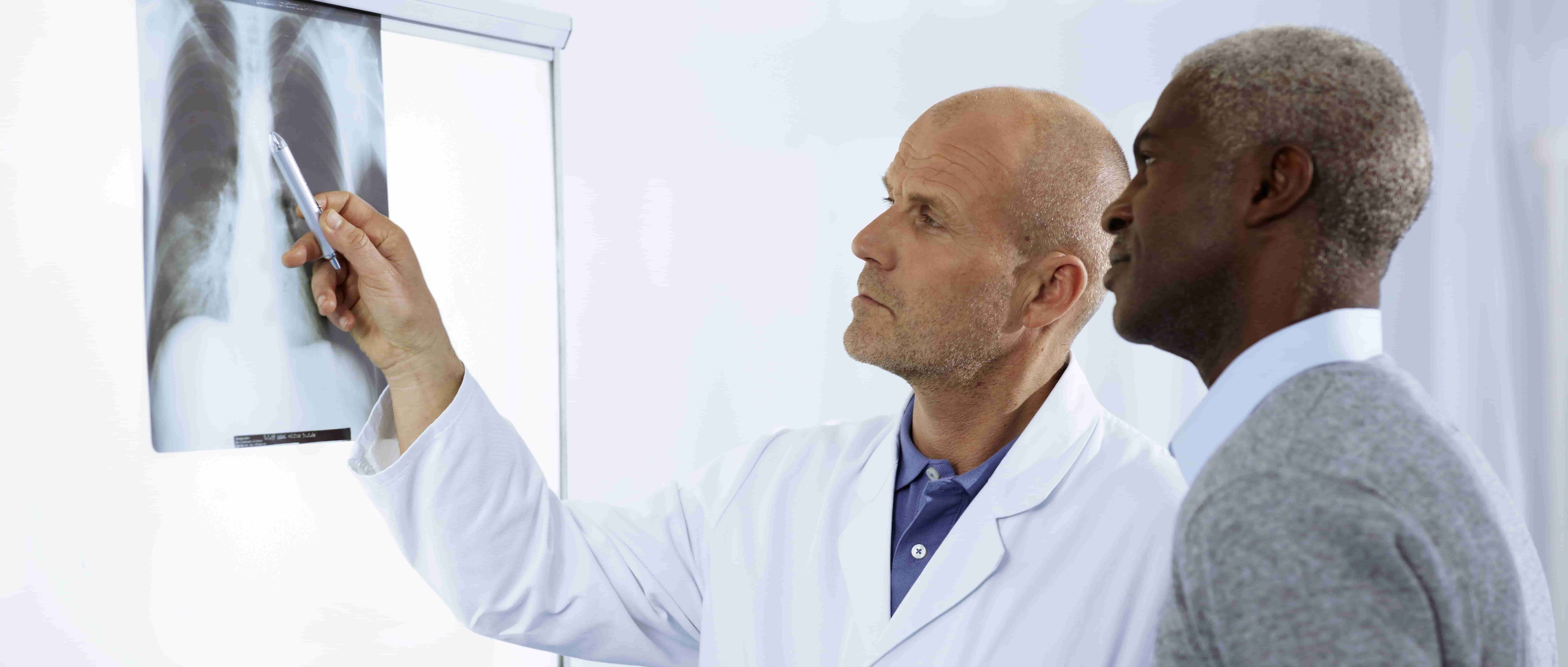Foto de um médico branco em pé, em um ambiente hospitalar, mostrando a um paciente negro de meia-idade, também de pé, a lâmina de um raio-x em uma tela de luz presa à parede e utilizando um objeto pontiagudo