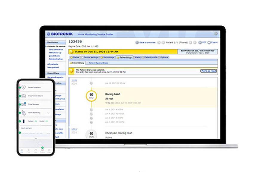 Home Monitoring and Patient App