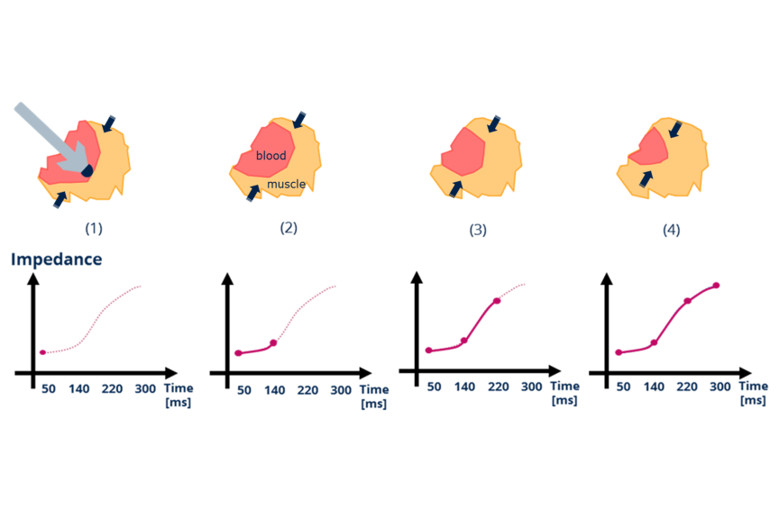 Closed Loop Stimulation