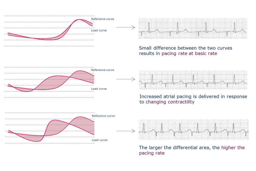 Closed Loop Stimulation