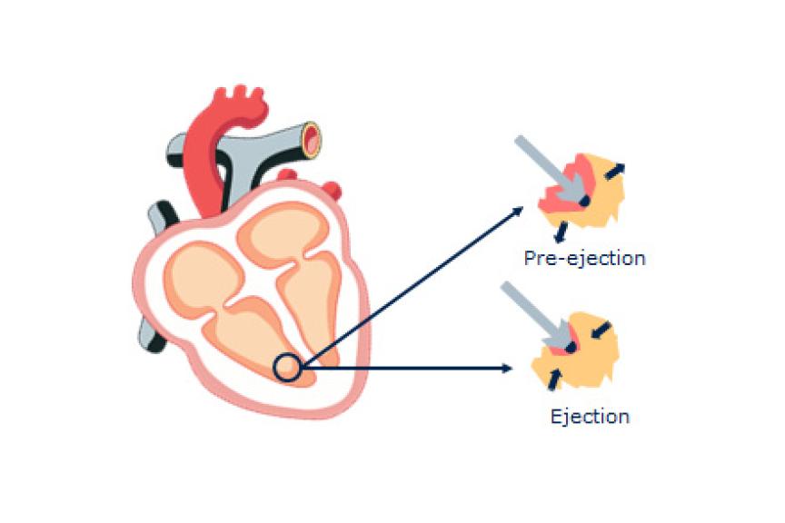 Closed Loop Stimulation