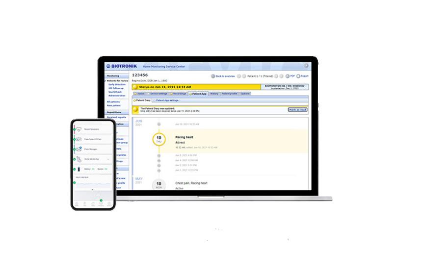 Remote Patient Monitoring Systems