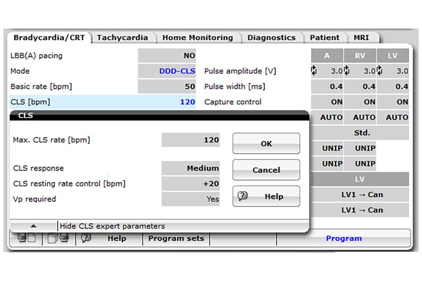 Closed Loop Stimulation