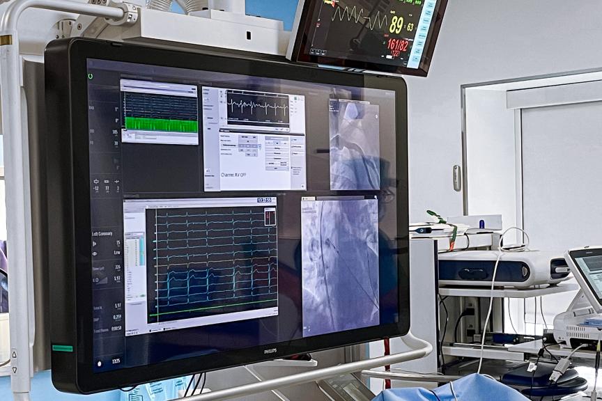 Implantation procedure of a pacemaker