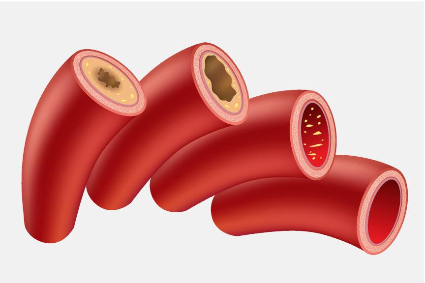 Illustration of arteries