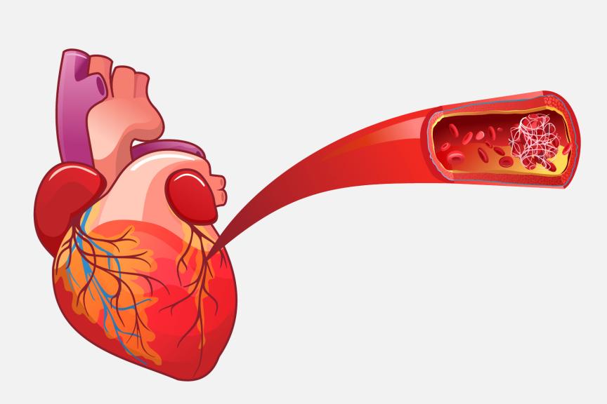 Illustration of a heart and artery