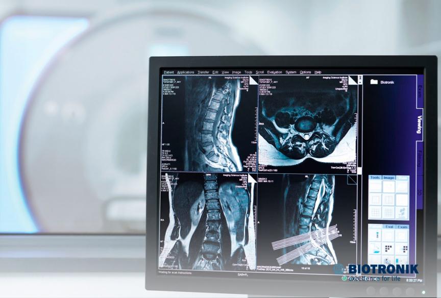 O que o cardiologista fará antes da minha ressonância magnética?