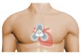 net_ECG_Torso