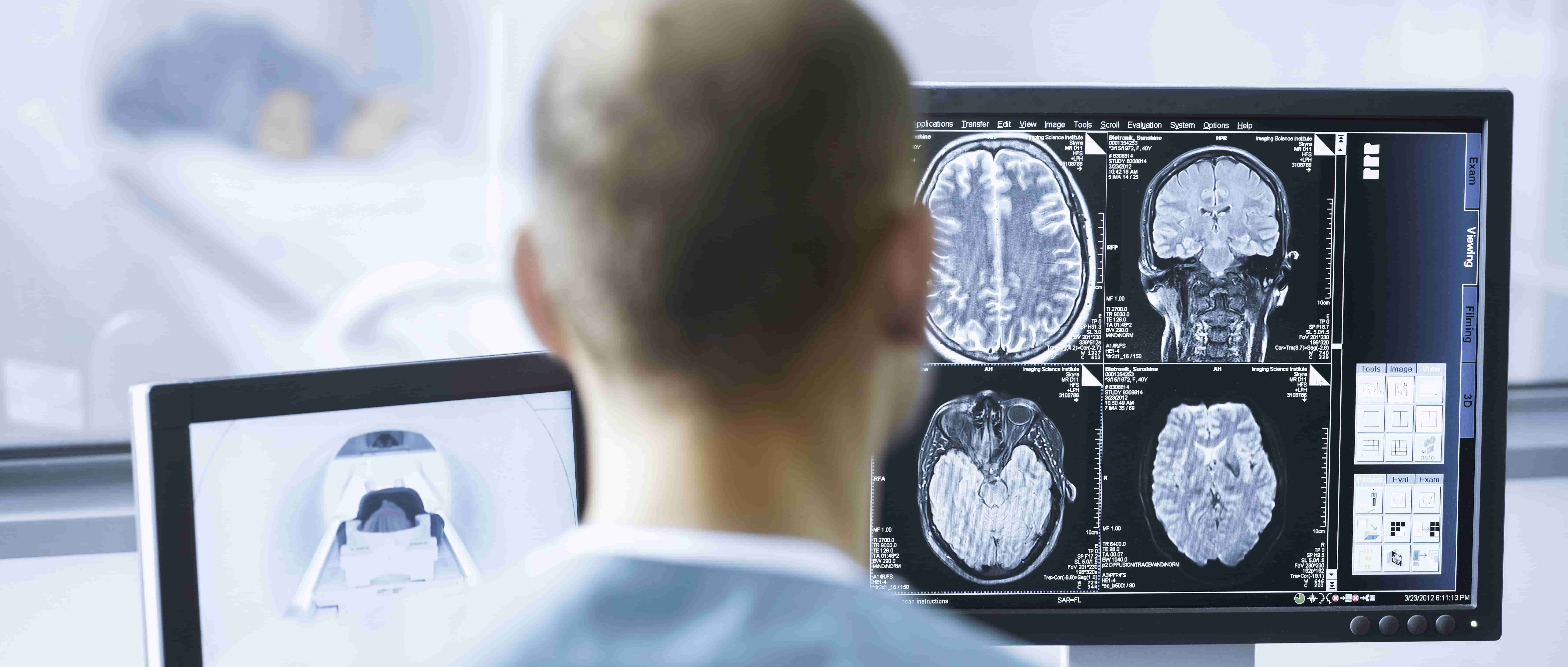 Foto de um médico de costas, sentado, de frente a uma tela de computador em primeiro plano que exibe um quadrante com imagens  de cérebros em diferentes ângulos