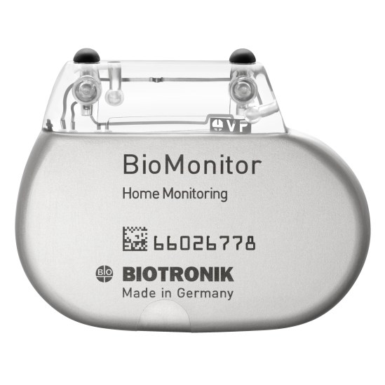 BioMonitor Arrhythmia Monitoring