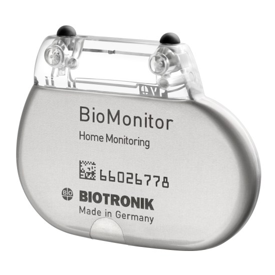 BioMonitor Arrhythmia Monitoring